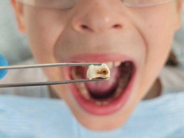 Professional Emergency Dental Service in SC